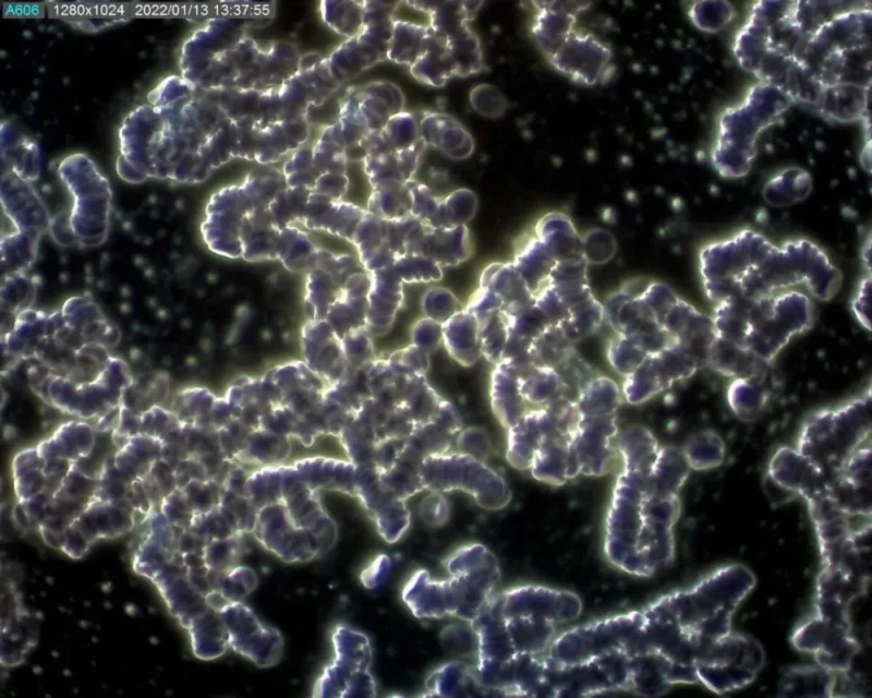 Kapka krve objevené alergie na lepek, laktózu nebo mléčnou bílkovinu