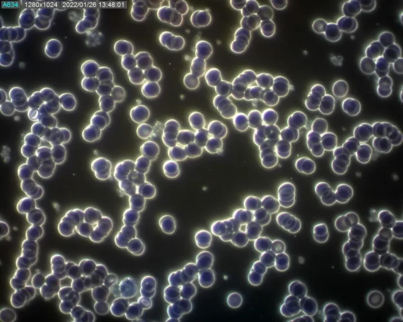 Kapka krve objevené alergie na lepek, laktózu nebo mléčnou bílkovinu